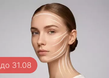 SMAS-лифтинг